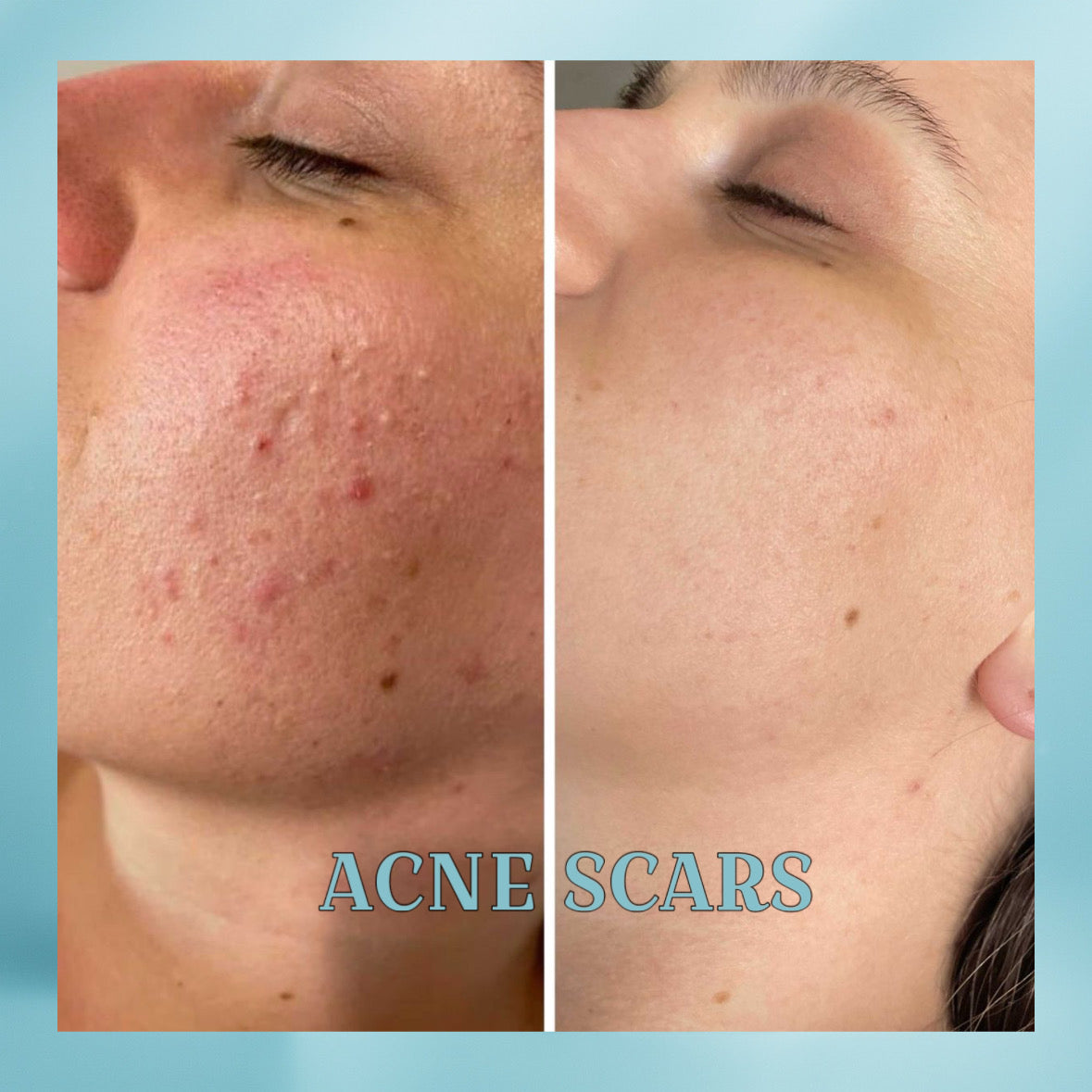 EETTSY K-Glow Dark Spot Corrector