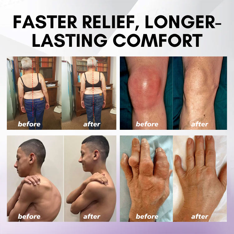 Eettsy™ Turmeric & Emu Oil Arthritis Soothing Pain Relief Massage Gel 👨‍⚕️Australian Osteopathic Association （AOA）Approved