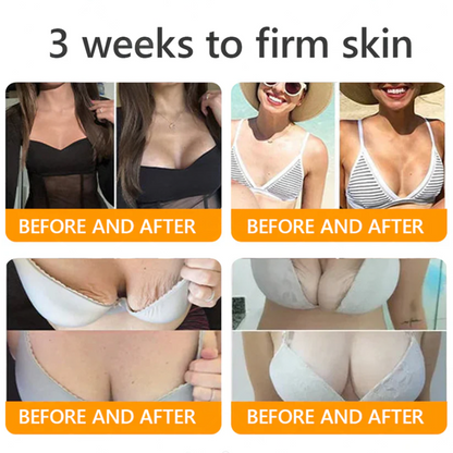 Botox Bee Venom Skin Restoration Cream - Anti-aging, Hydrating, Skin Firming & Lifting, Skin Repair, Even Tone, Acne and Dark Spot Treatment, Wart and Mole Removal, and Psoriasis Relief.