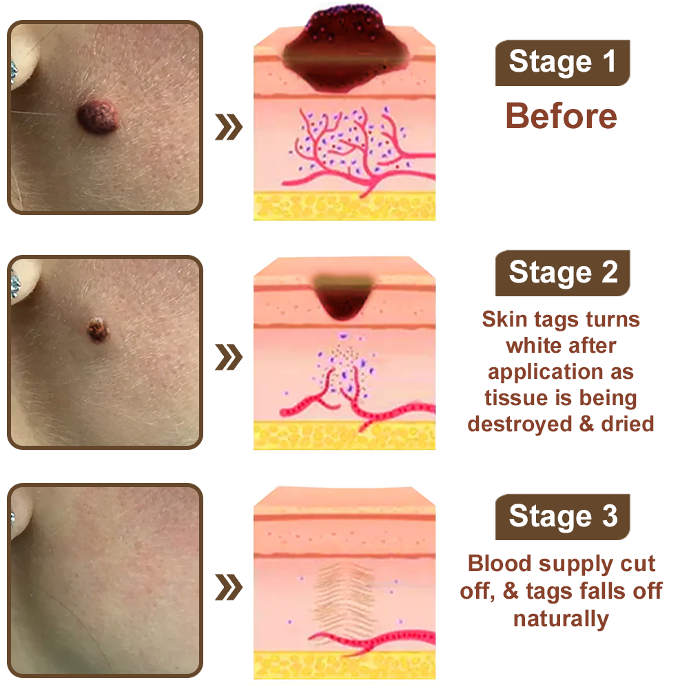 Black Rice Skin Repair Cream ⚕️ FDA Certified – Targets Warts, Psoriasis & Pigmentation