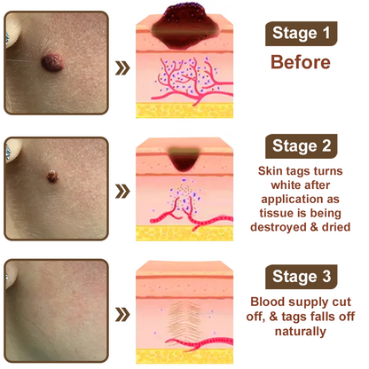 Black Rice Skin Repair Cream ⚕️ FDA Certified – Targets Warts, Psoriasis & Pigmentation