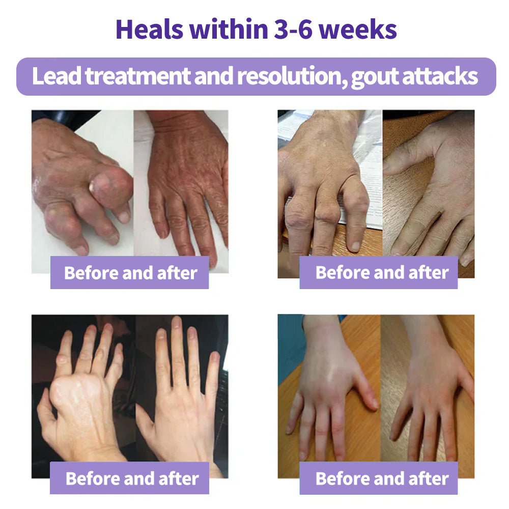 Eettsy™ Turmeric & Emu Oil Arthritis Soothing Pain Relief Massage Gel 👨‍⚕️Australian Osteopathic Association （AOA）Approved