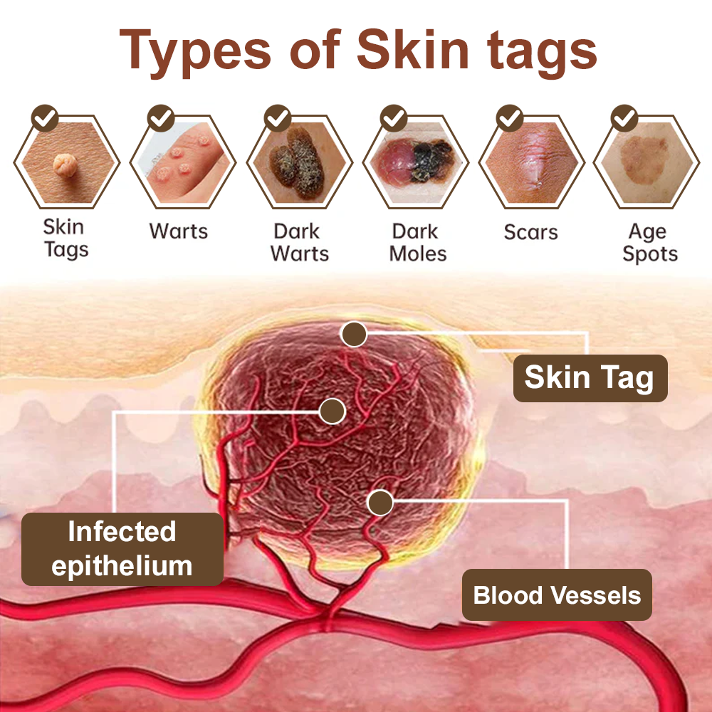 Black Rice Skin Repair Cream ⚕️ FDA Certified – Targets Warts, Psoriasis & Pigmentation