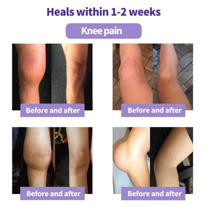 Eettsy™ Turmeric & Emu Oil Arthritis Soothing Pain Relief Massage Gel 👨‍⚕️Australian Osteopathic Association （AOA）Approved