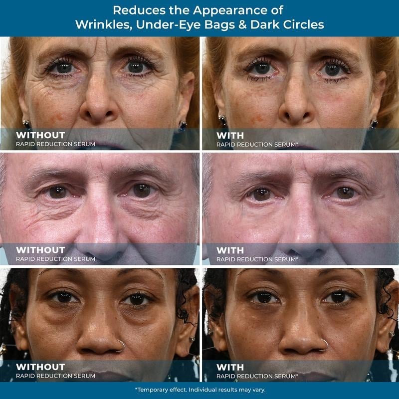 24-Hour Flash Deal⏰✨ Rapid Reduction Eye Serum – Instant Tightening & Anti-Aging for Eyes & Face (20ml) ✨