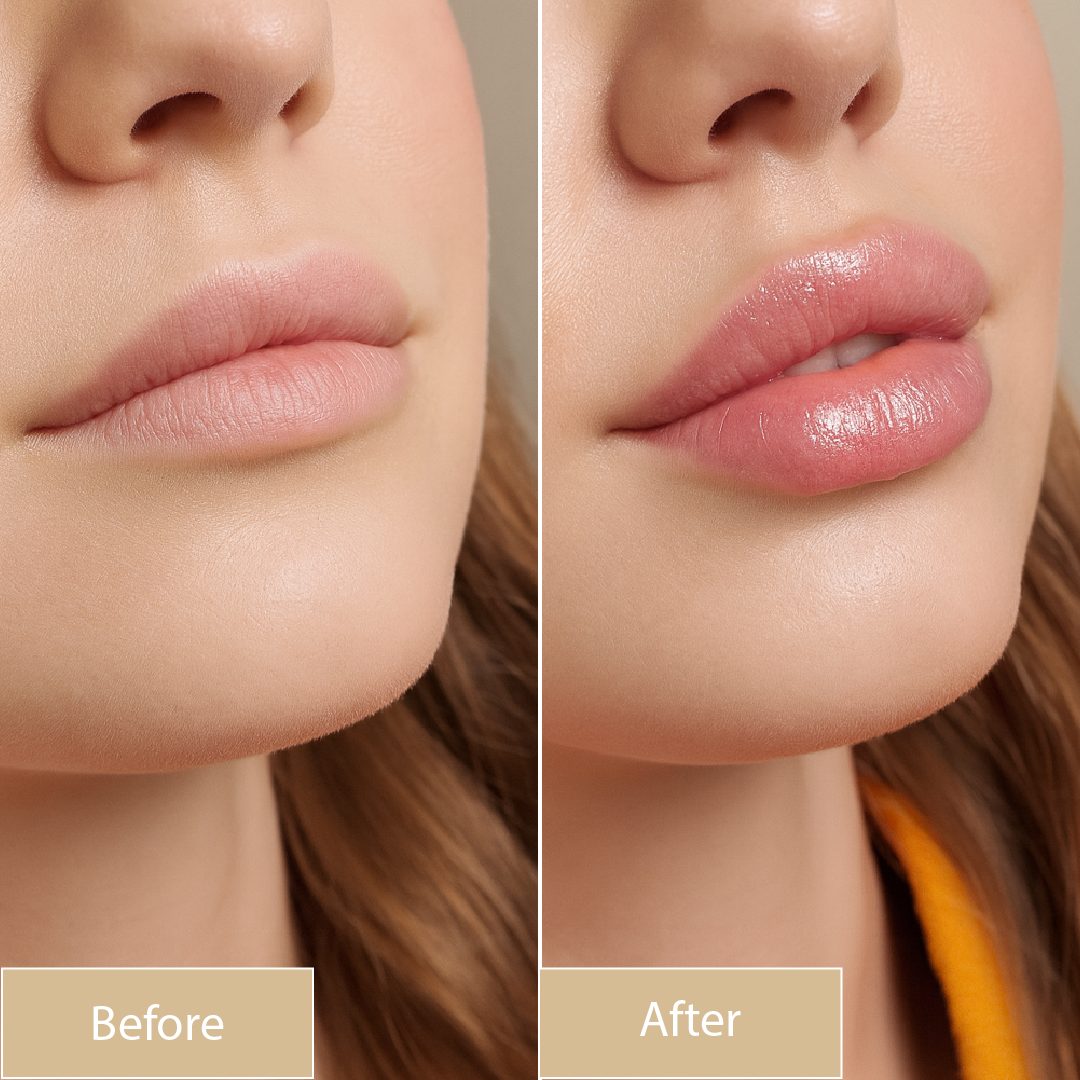 Kehyla Beauty - Lip Plumper