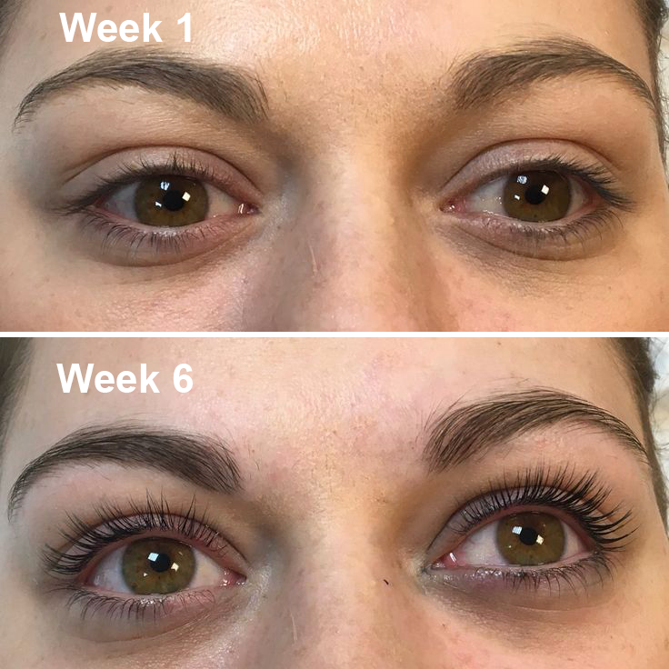 Kehyla Beauty - Lash Serum