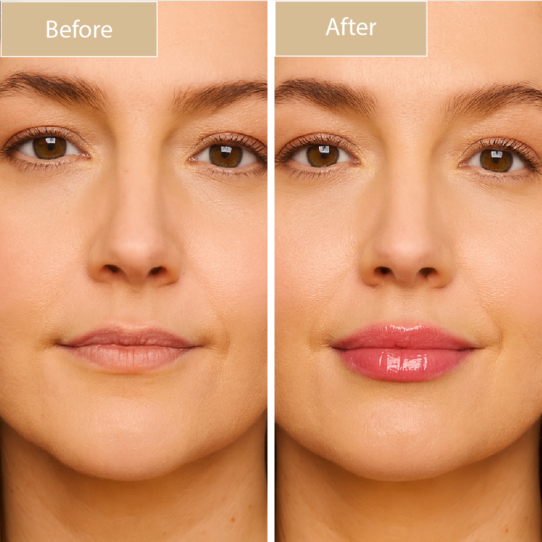 Kehyla Beauty - Lushlip Butter