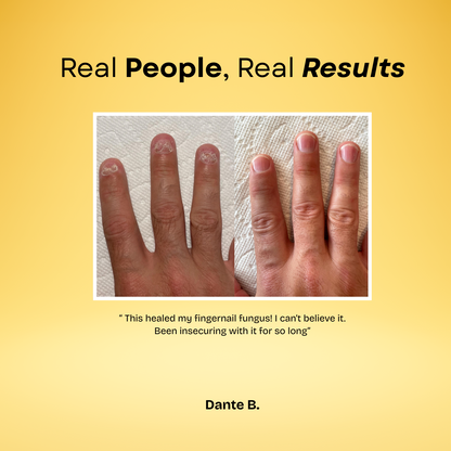 7 Day Nail Treatment Serum🍃Natural ingredients & Fast results